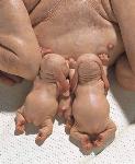 the_most_controversial_art_sculptures_by_patricia_piccinini24.jpg